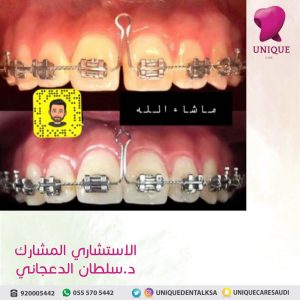 after-before-uniquecare-10